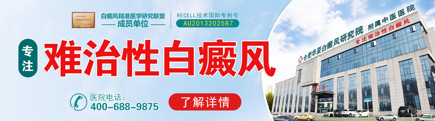 滁州白癜风医院